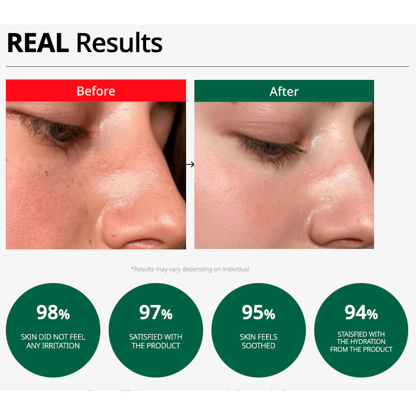 DR.G R.E.D BLEMISH Clear Soothing Cream (70ml)
