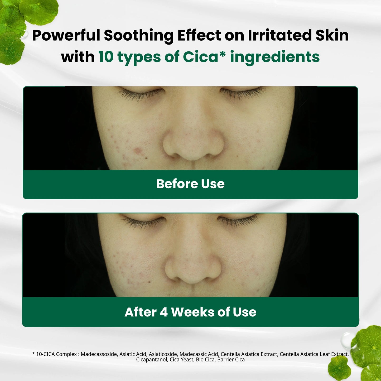 DR.G R.E.D BLEMISH Clear Soothing Cream (70ml)