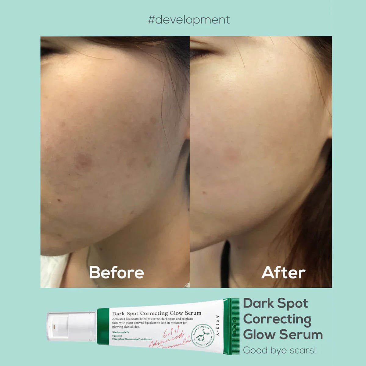 AXIS-Y - Dark spot correcting glow serum