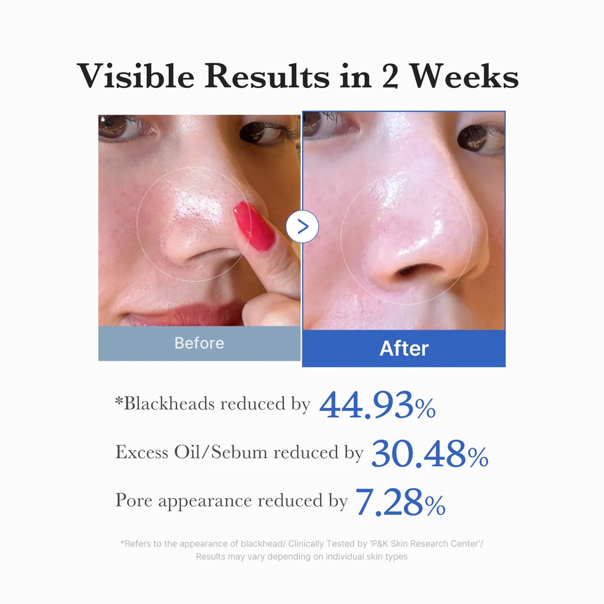 medicube - Zero Pore Pad 2.0
