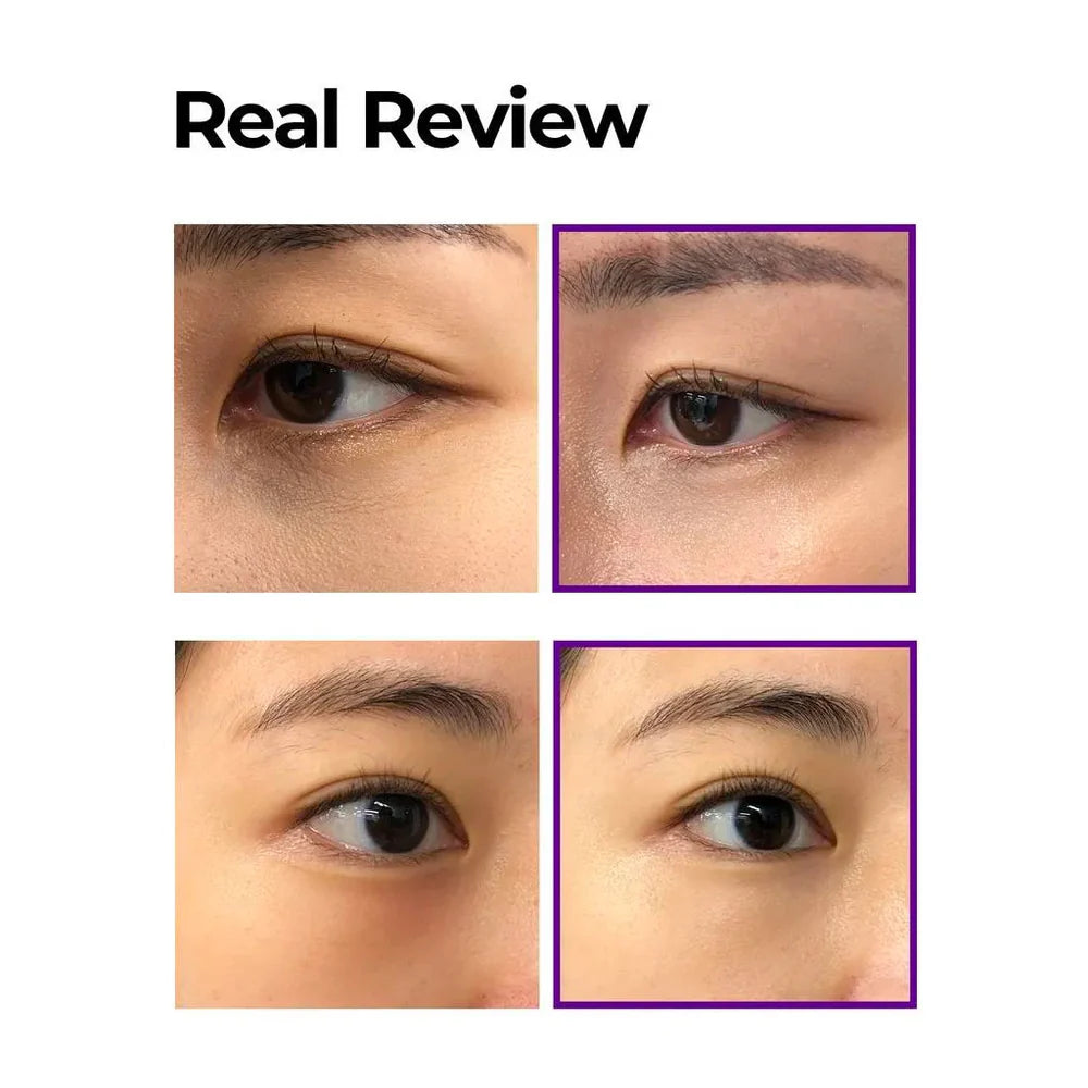 SOME BY MI - Retinol Intense Advanced Triple Action Eye Cream