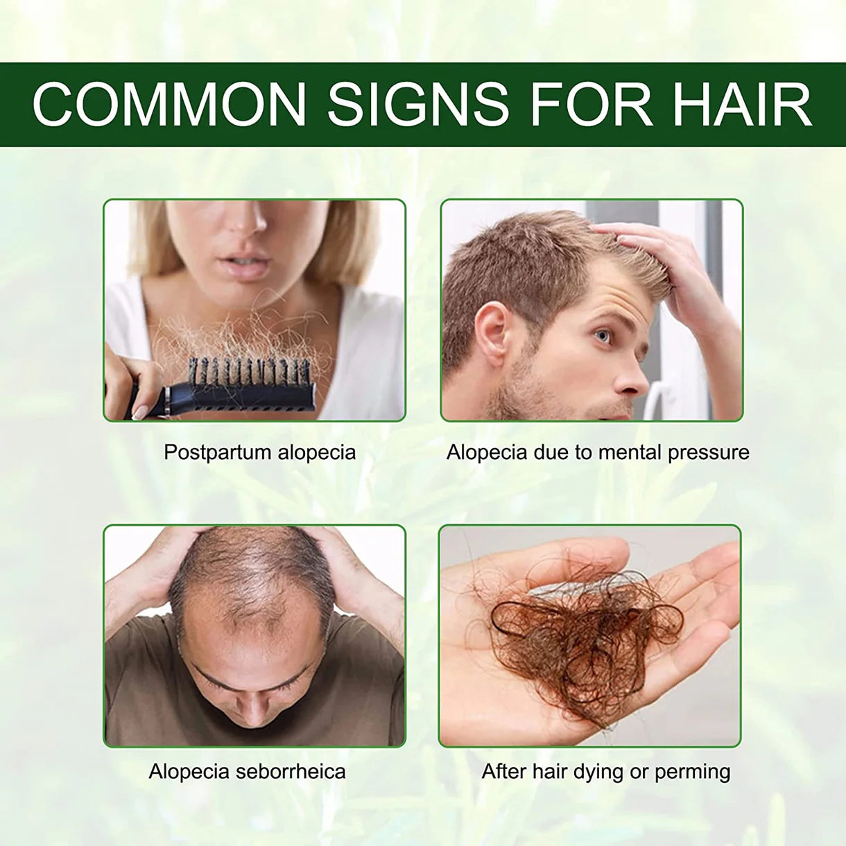 Aliver Rosemary Oil for Hair Growth