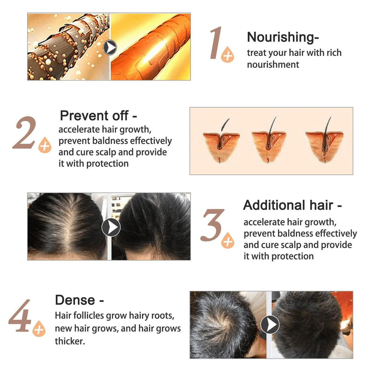 Aliver Rosemary Oil for Hair Growth
